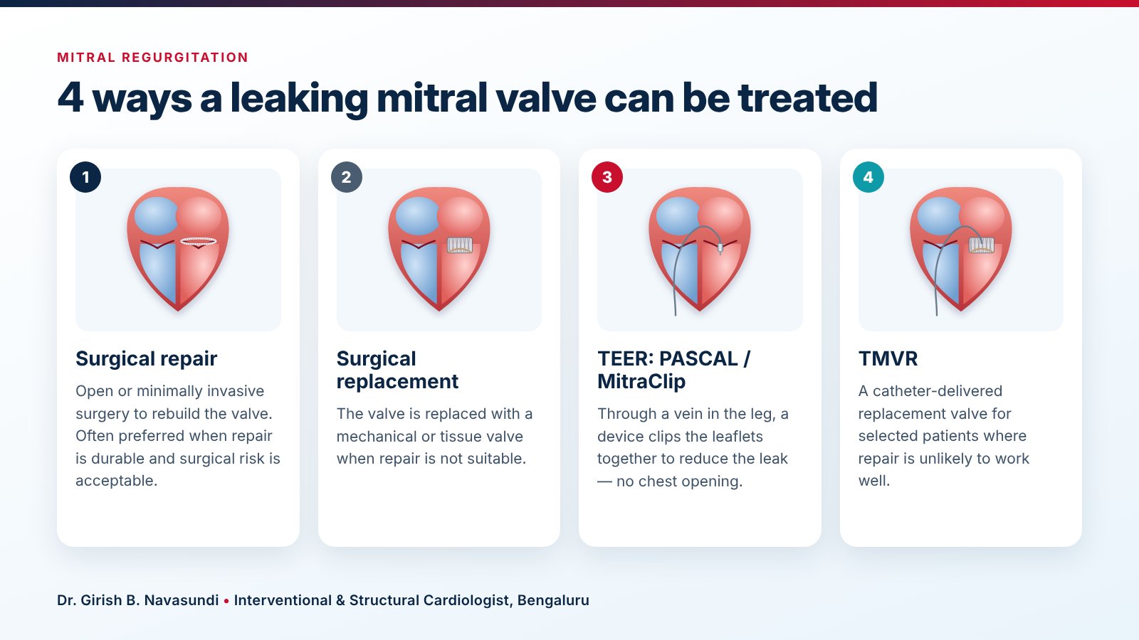 4 ways a leaking mitral valve can be treated: surgical repair, surgical replacement, TEER with PASCAL or MitraClip, and TMVR
